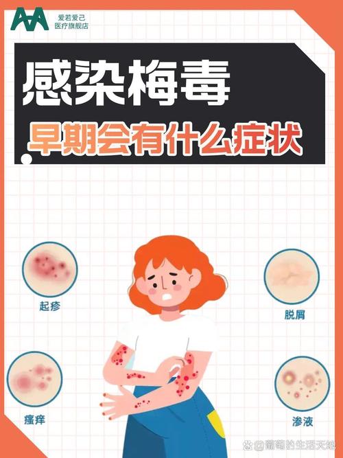 梅毒早期小红点症状图片对比:如何通过皮肤变化识别感染迹象 梅毒早期小红点症状图片对比:如何通过皮肤变化识别感染迹象