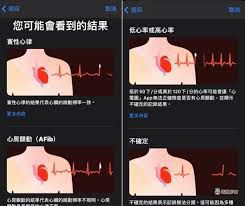 苹果手表如何获取心电图数据—如何使用苹果手表查看心电图 苹果手表如何获取心电图数据—如何使用苹果手表查看心电图