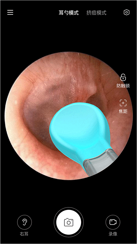 Xlife掏耳勺最新版